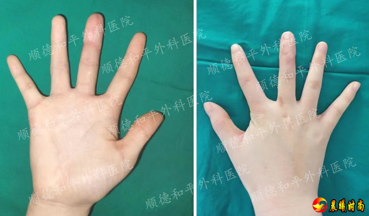 经过医护团队５个多小时的努力