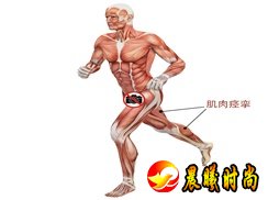 使得肌肉的神经行动频率突然增加