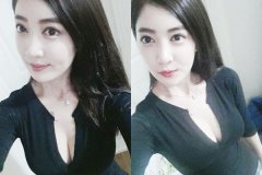 <b>如何整治胸部下垂呢？</b>