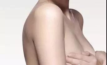 乳房下垂的女人需要做的五件事