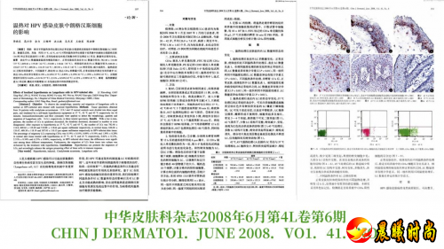 特定波光能免疫诱导疗法：HPV感染治疗新选择