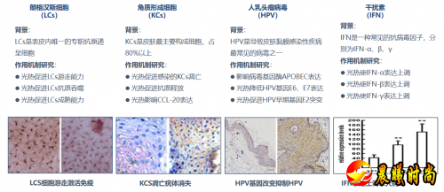 特定波光能免疫诱导疗法：HPV感染治疗新选择