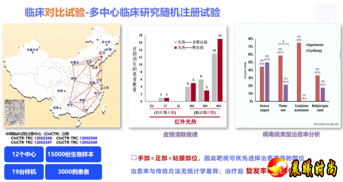 特定波光能免疫诱导疗法：HPV感染治疗新选择